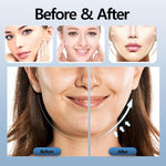 Load image into Gallery viewer, V-Face Beauty Device - BestShop
